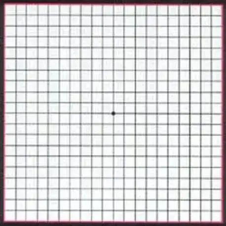 Amsler grid for daily vision monitoring